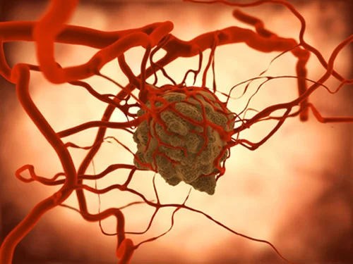 循環血中腫瘍DNAによる液体生検は肺がんのEGFR遺伝子変異発見に有用