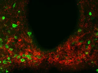 アミリンとレプチンが食物摂取量と体重を調節する機序を新研究が示唆