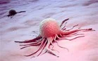 過去20年でアメリカのがん死亡率が22%低下、低下率北東部で最大、南部で最小