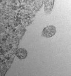 樹状細胞由来のエクソソームが多発性硬化症の治療候補に - Neuroscience 2013