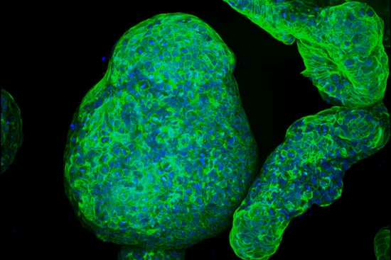 完全に合成された新しいゲルを用い膵臓オルガノイドを作製。膵臓癌の新しい治療法の開発と試験に役立つことが期待される。