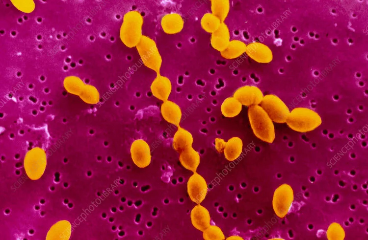 肺炎球菌感染の記憶を保持する上皮細胞の新発見