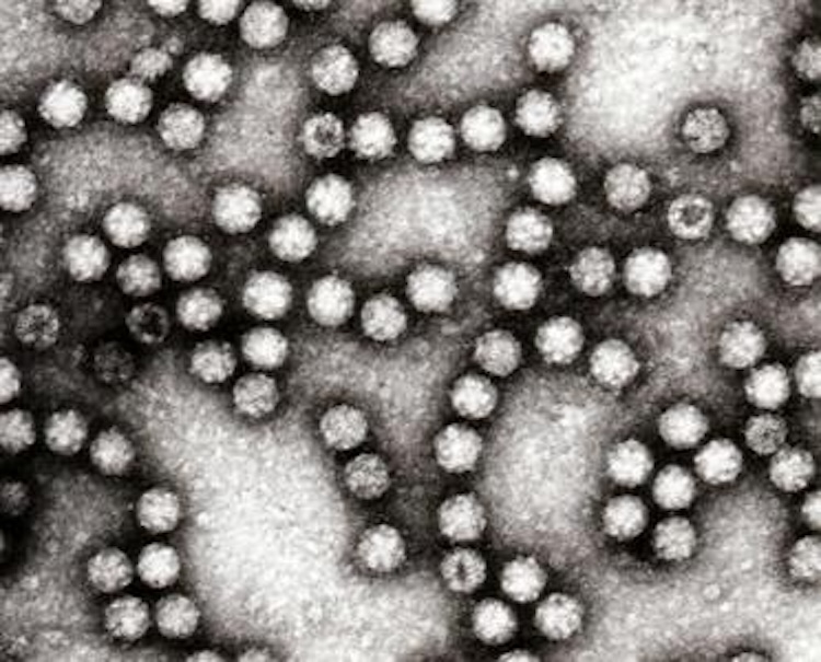 ヒトアストロウイルスの侵入メカニズムを解明!ワクチン開発に光