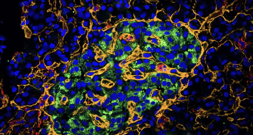 膵臓の「平和維持部隊」を発見:1型糖尿病治療を変える血管関連線維芽細胞(VAFs)とは