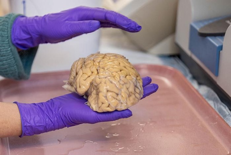 驚異の記憶力を持つ高齢者「スーパーエイジャー」の脳は、何が違うのか?